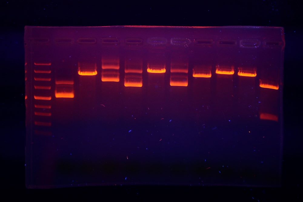 DNA bands