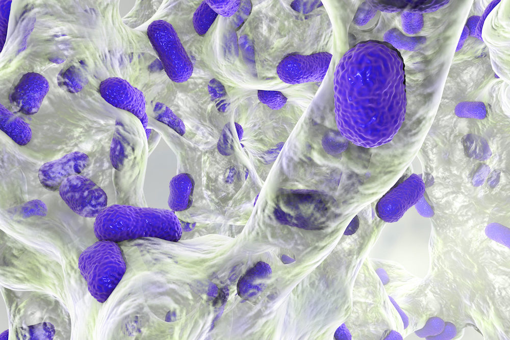 biofilm